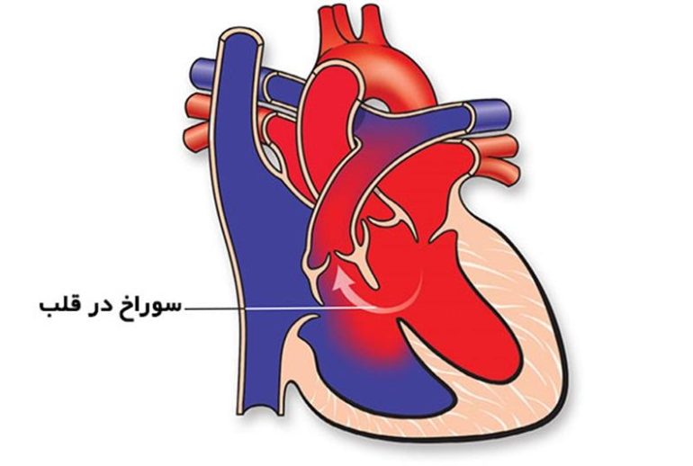 1734369613.417178_371607_image