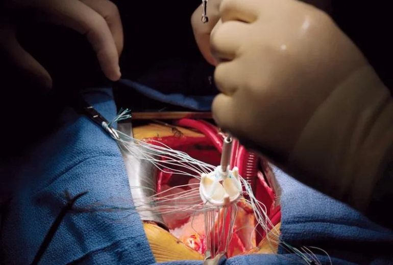 1734369635.04943_736419_image