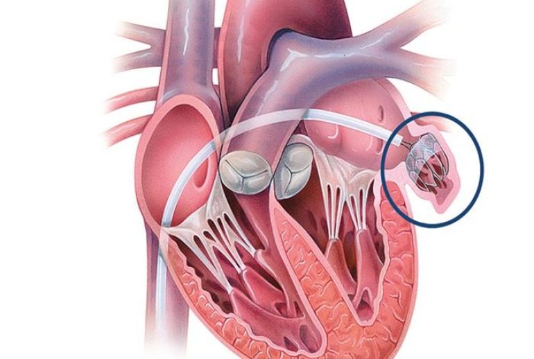 1734369706.677934_588161_image