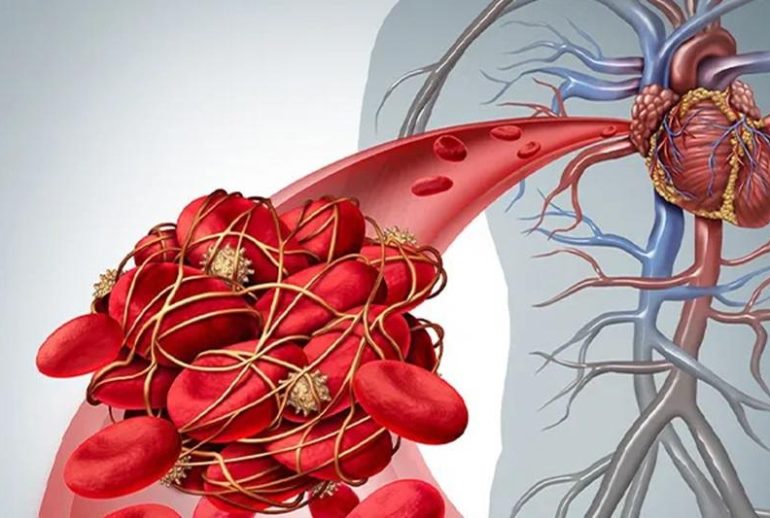 1734369772.484605_852500_image